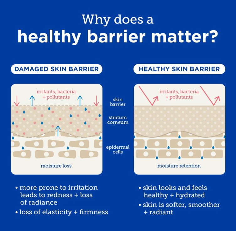 Ringworm vs. Eczema: How to Tell the Difference